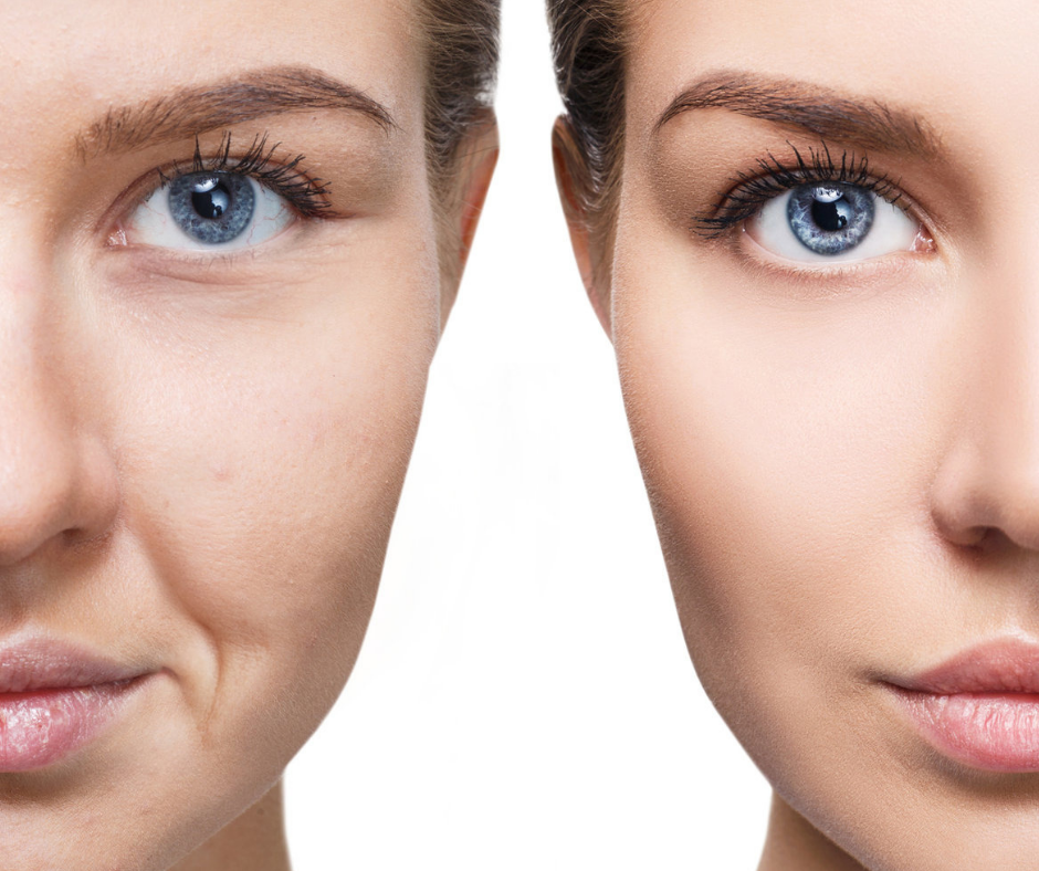 Meso Beauty Therapy & Xo cell Plasma