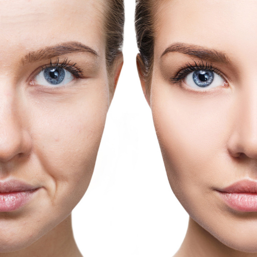 Meso Beauty Therapy & Xo cell Plasma